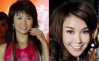 爆料娱乐圈没整容明星,揭秘未整容的明星风采